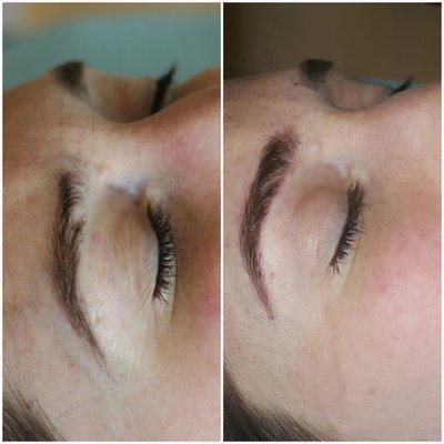 I love being able to fill in sparse patches or old scars with microblading!