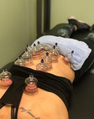 Cupping