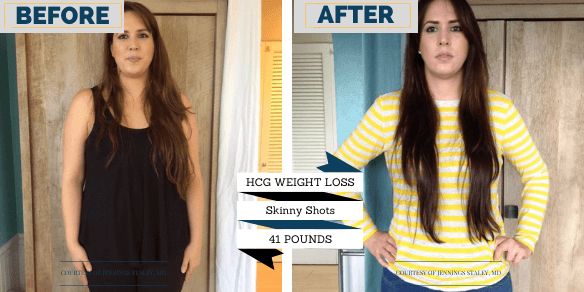 The Botox Bar & Wellness Medical Weight Loss