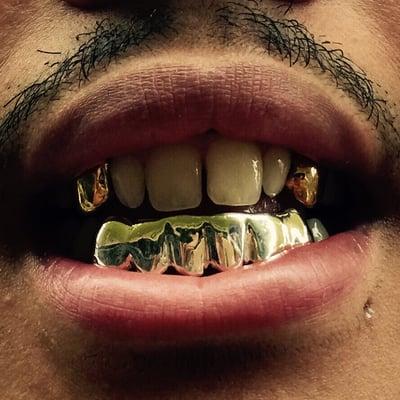 Gold Fang Caps & Silver Bottom Grill