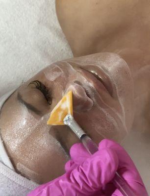 Custom Enzyme Facial to proliferate cells, and improve tone and texture.