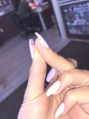 How they fix a crooked nail