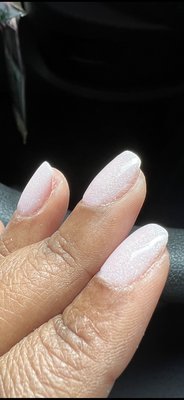 Nails clipped inward with a cuticle clipper , making it an unnatural nail shape