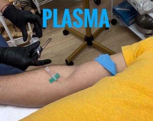 Plasma PRP