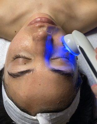 LED light therapy for acne and scarring