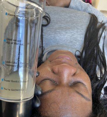 Hydrafacial done on my client. Our gunkie jar shows the dirt, debris and oils within my client's face.