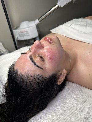 Hydrating facial on client who has rosacea