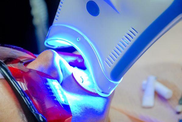 LED Teeth Whitening