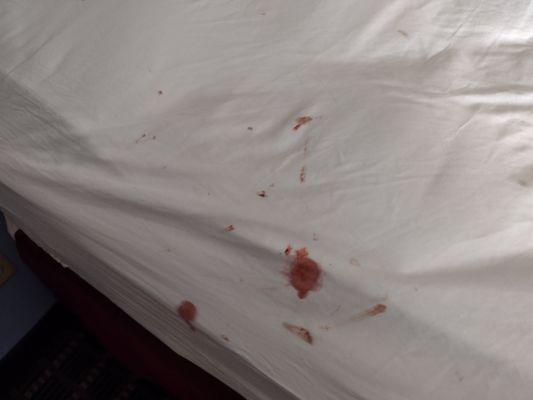 Blood on sheets no pathogen cleaners or boxes or service to dispose properly