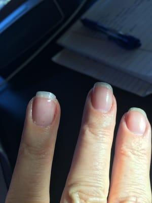 Flecks of former red polish still on bumpy nails.