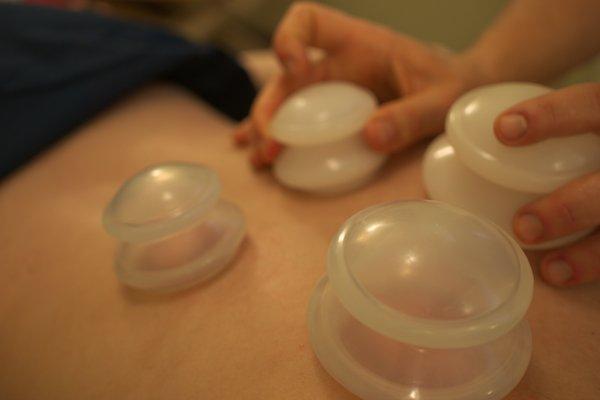 Cupping sessions at Nova