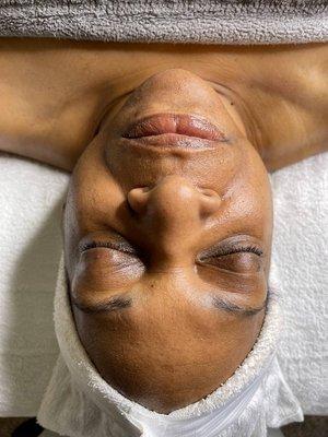 Anti-aging Facial