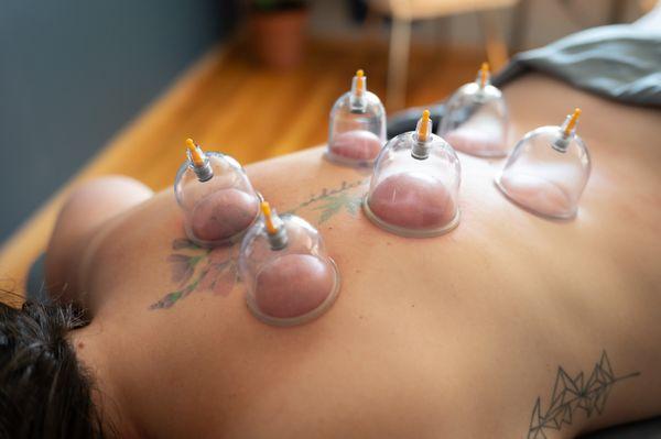 Cupping Therapy Add On