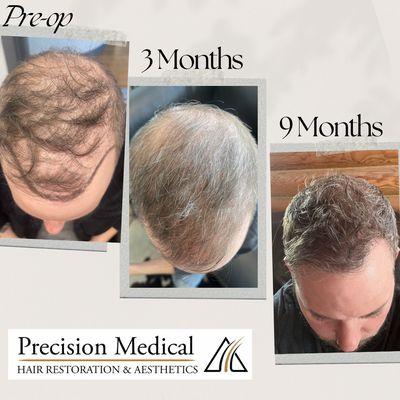 Transformative hair restoration with individually tailored treatment programs