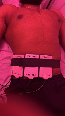 Non-invasive Laser Lipo treatment