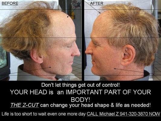 So many things can change real fast!!! No surgery necessary!! It's a real game changer!!