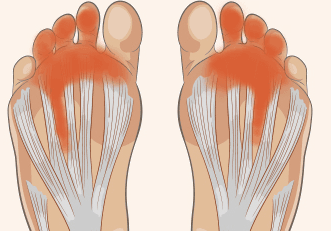 B12 Deficiency-peripheral neuropathy. Vegans and vegetarians, you've been warned.