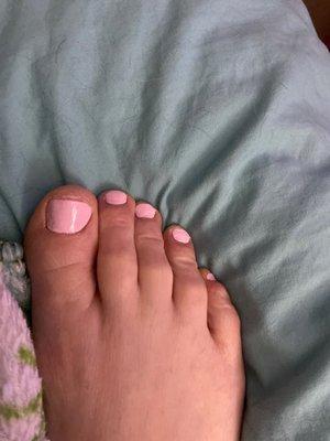 Toes look great for a old lady's foot!!