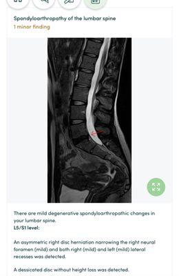 Informational finding of spine