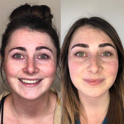 Photo on left: before Microblading // photo on right: after follow up session of 3D microblading.