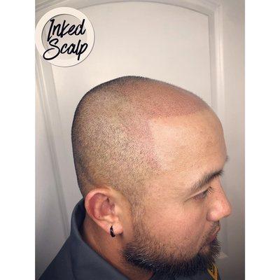 Inked Scalp