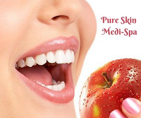 Pure Skin Medi-Spa Lafayette La...Ask about our teeth whitening!!