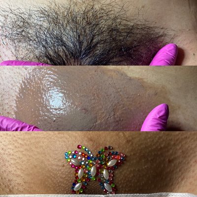 Before & After a professional Brazilian wax done right $65.00 add a mini Vajacial for $20.00 more