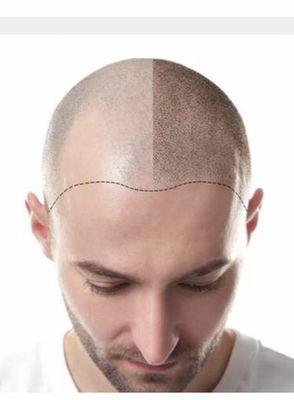 Scalp pigmentation