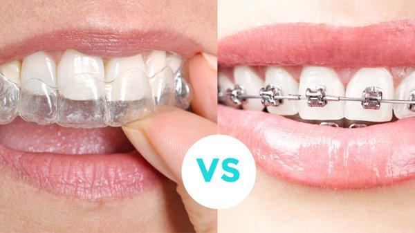 FREE Braces or Invisalign Consultation