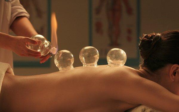 Cupping