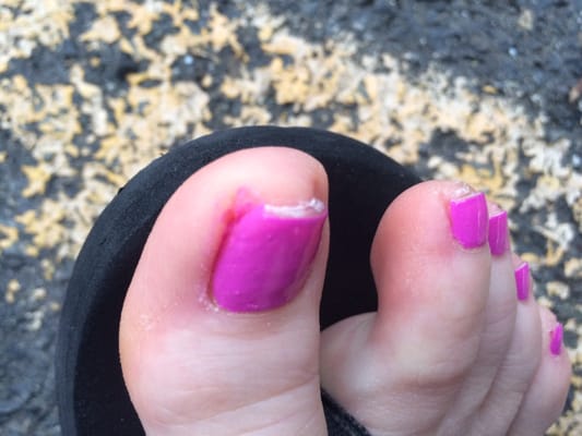 Toe was bleeding- nail tech NOT licensed!!