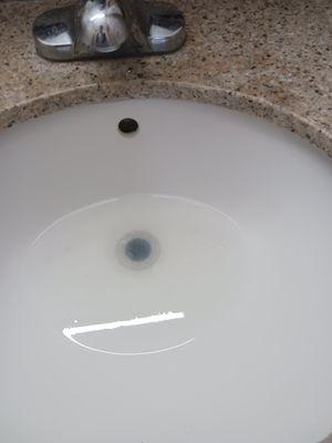 Sink would not drain. Zoom in to see facial hairs in sink from previous tenant.