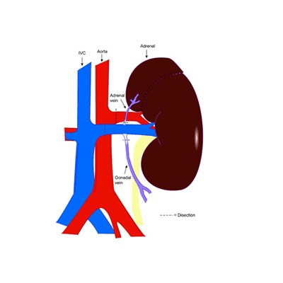 Bloomington Kidney & Hypertension Specialists PC