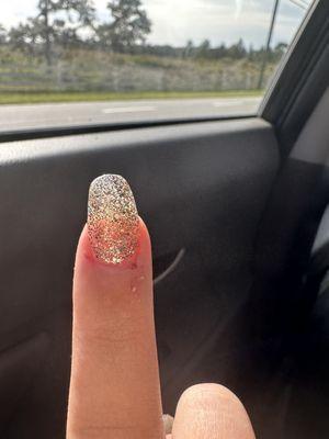 Damaged and sore nail