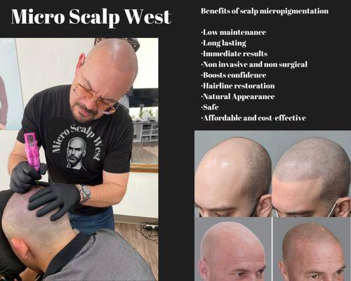 MICROSCALP WEST LLC