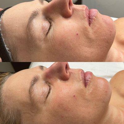 CBD facials