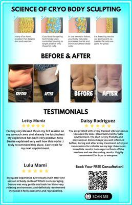 Science of Cryo Body Sculpting and Testimonials