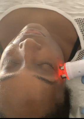 Radio Frequency Facial