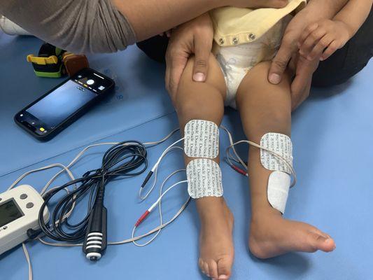 Excellence in E-Stim for KIDS. Diagnosis include: CP, Spina Bifida, Brachial plexus injury.