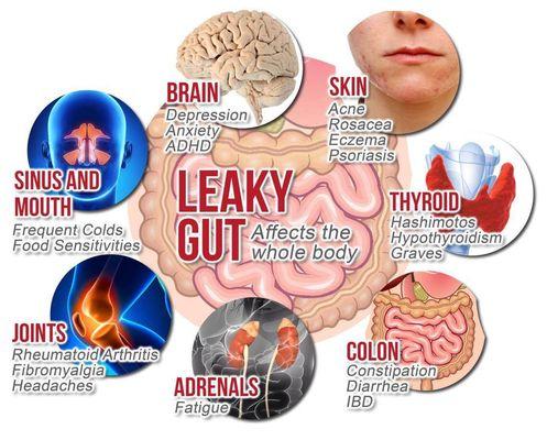 Treat your gut health!