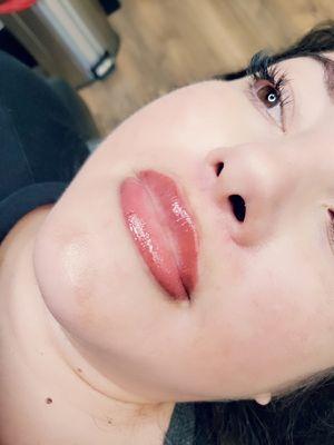 Lips