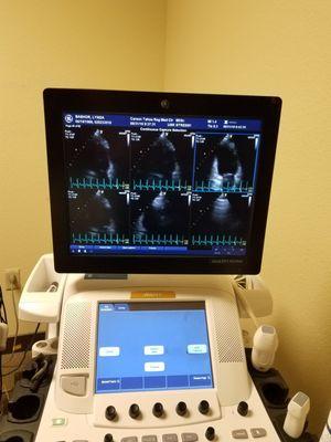 Echo Heart test