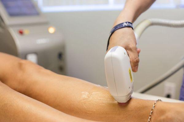 Laser Hair Removal