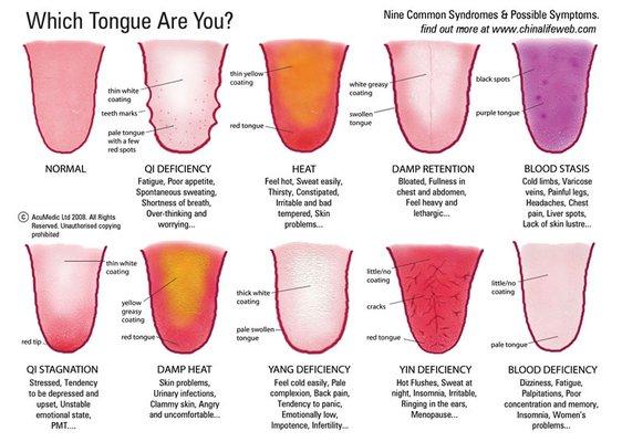 An overview of Tongue Diagnosis.