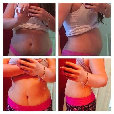 Waist training in our waist Cinchers - In just 11 days this is her results. Start our 30 day Sexy Curves Program.