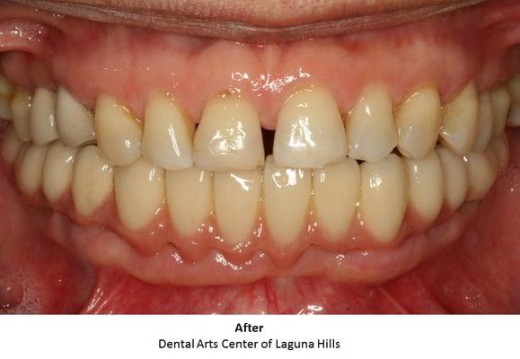 Cosmetic Dentistry