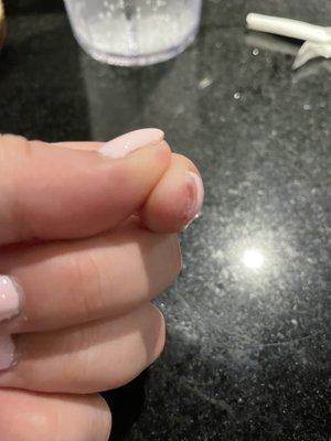 Nail glue stuck to my finger