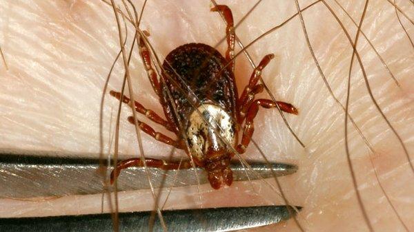 American Dog Tick, also  known as the wood tick, the gets its name from the fact that adult ticks prefer to feed on domestic dogs.