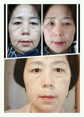 One of eunyoung park aesthetics anti-aging treatment program with korean style hand massge.