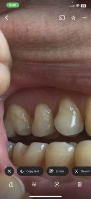 Look at these fillings, horrible job